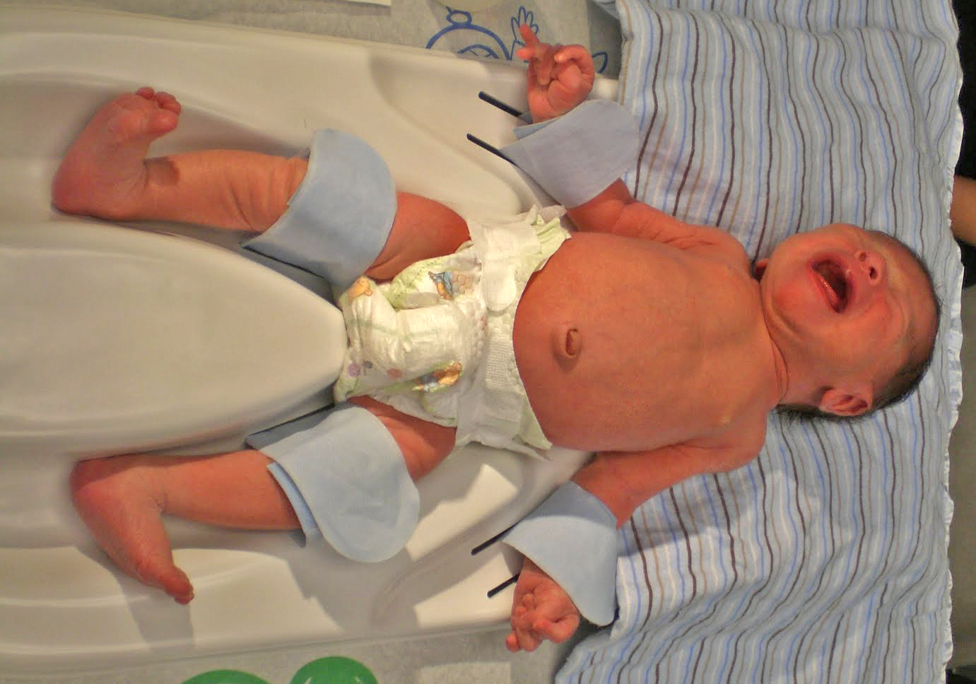 Procédure après la circonision - Guérison du bébé - Gentle Procedures NB