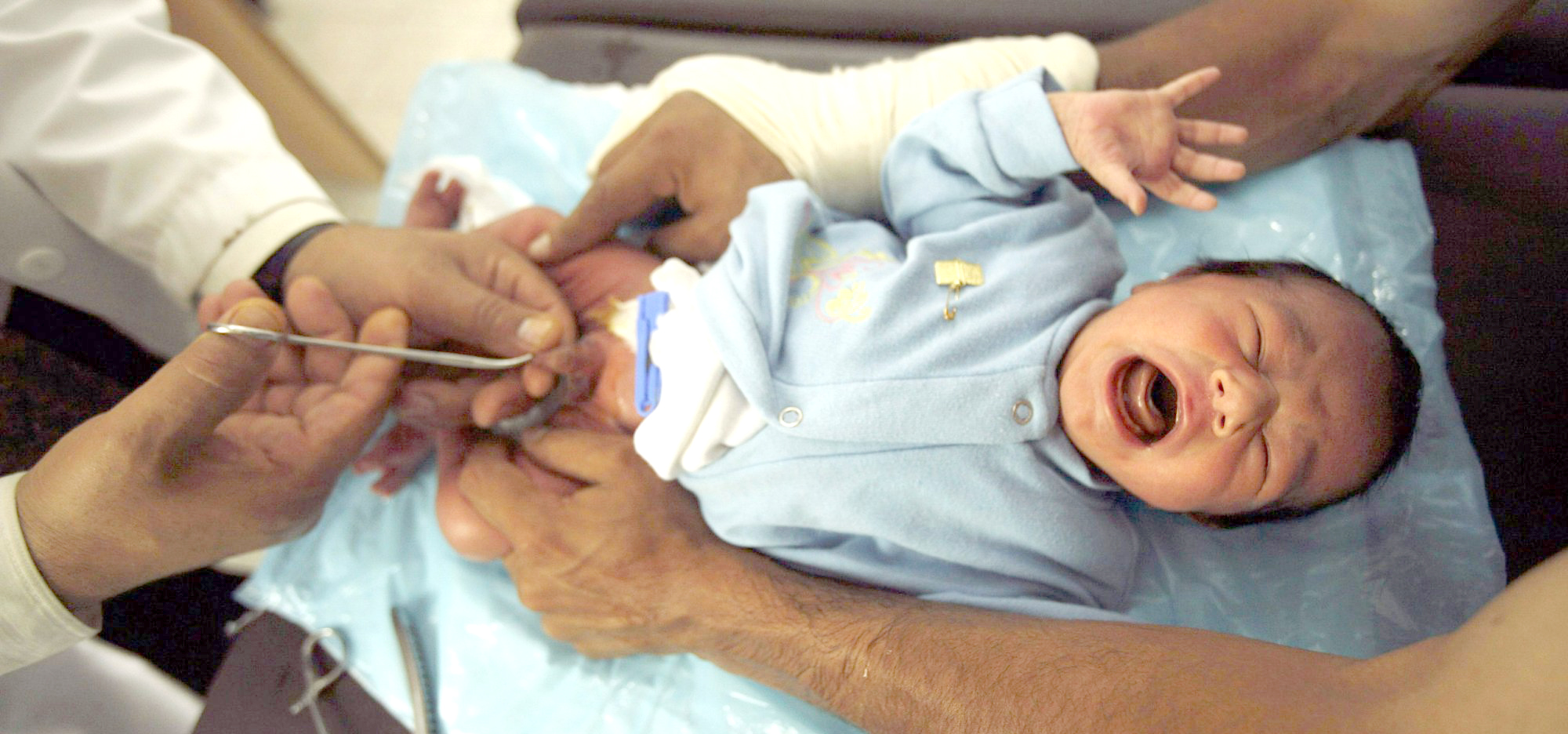 A Circumcision Begins