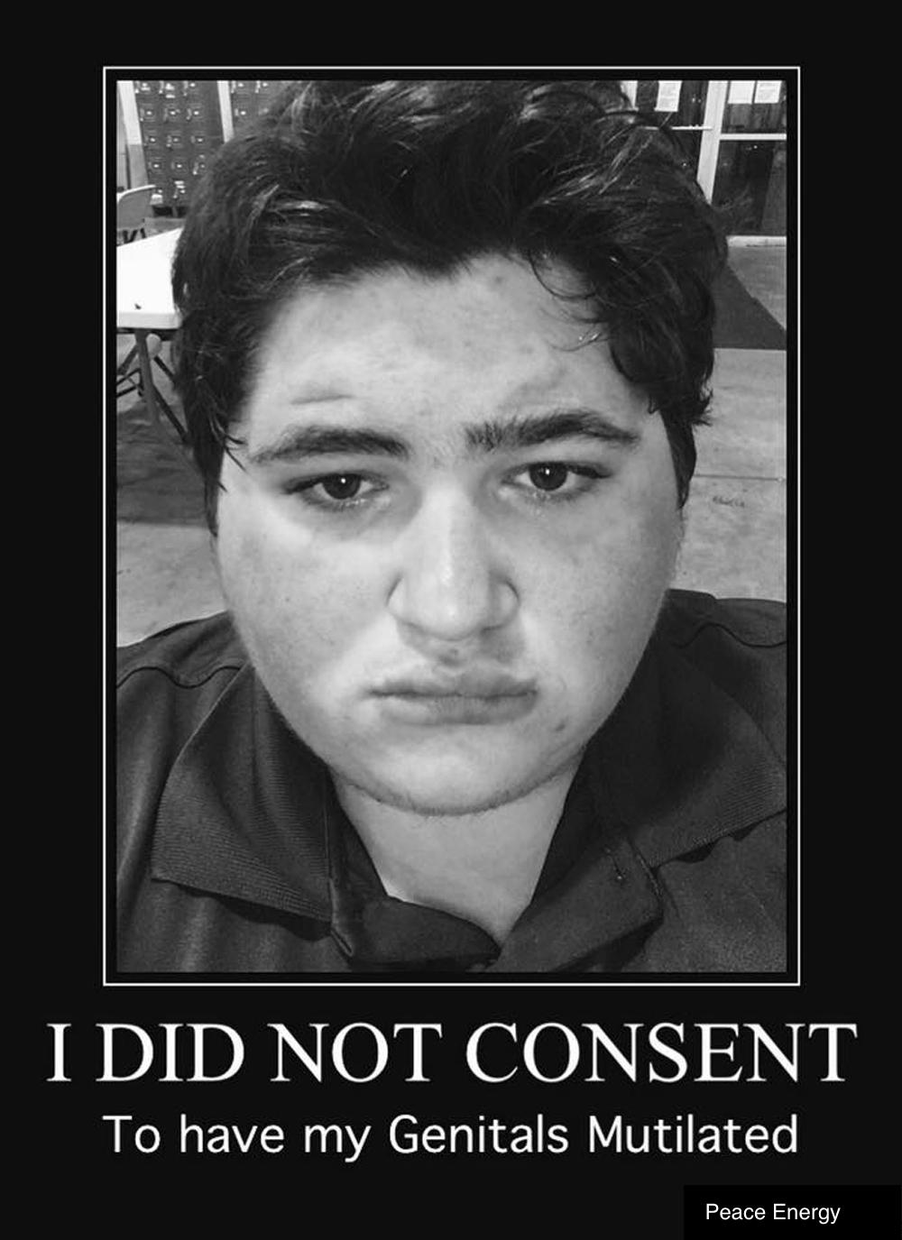 Austin did not consent to genital mutilation Austin did not consent to genital mutilation